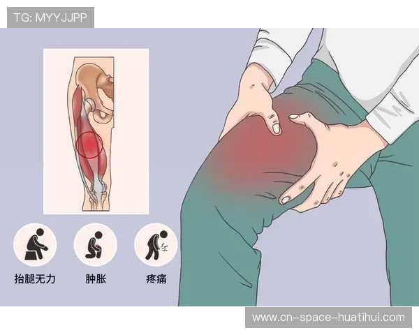 罗马佩莱格里尼训练中股四头肌受伤，拉伤风险存忧